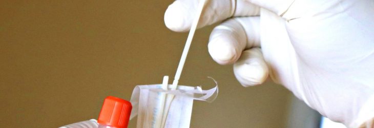 covid test tatry poprad antigen zmeny nove